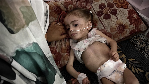Maryam... La historia de un pequeño cuerpo agonizante a causa del hambre del enemigo sionista