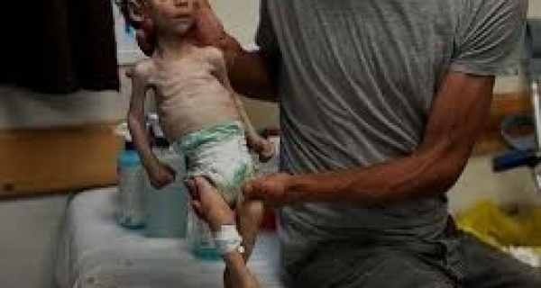Madres e hijos: El hambre está destruyendo el presente y el futuro de Gaza