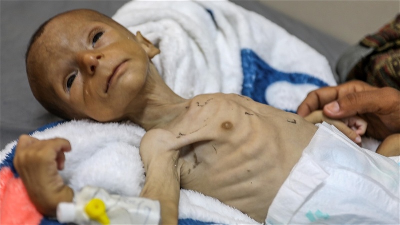 Dos Años de Genocidio: Cifras que Reflejan la Alcance de los Crímenes Sionistas y la Sangría Palestina