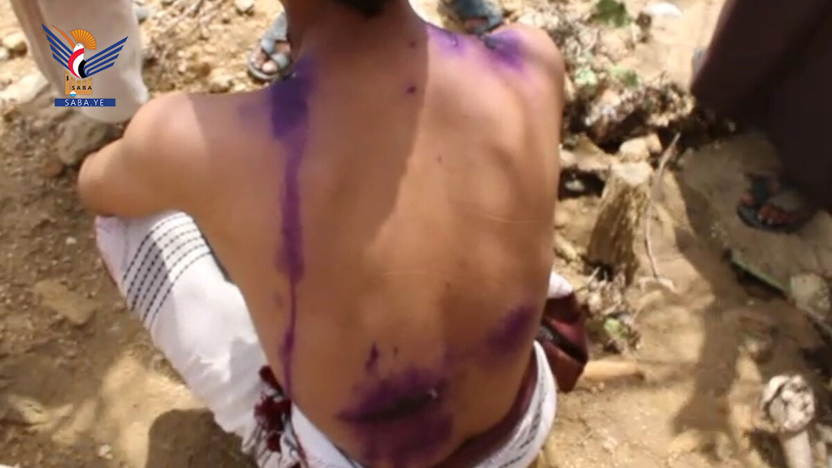 Un ciudadano murió y otros seis resultaron heridos en los distritos de Dhahir y Haidan debido a torturas perpetradas por el ejército saudíta