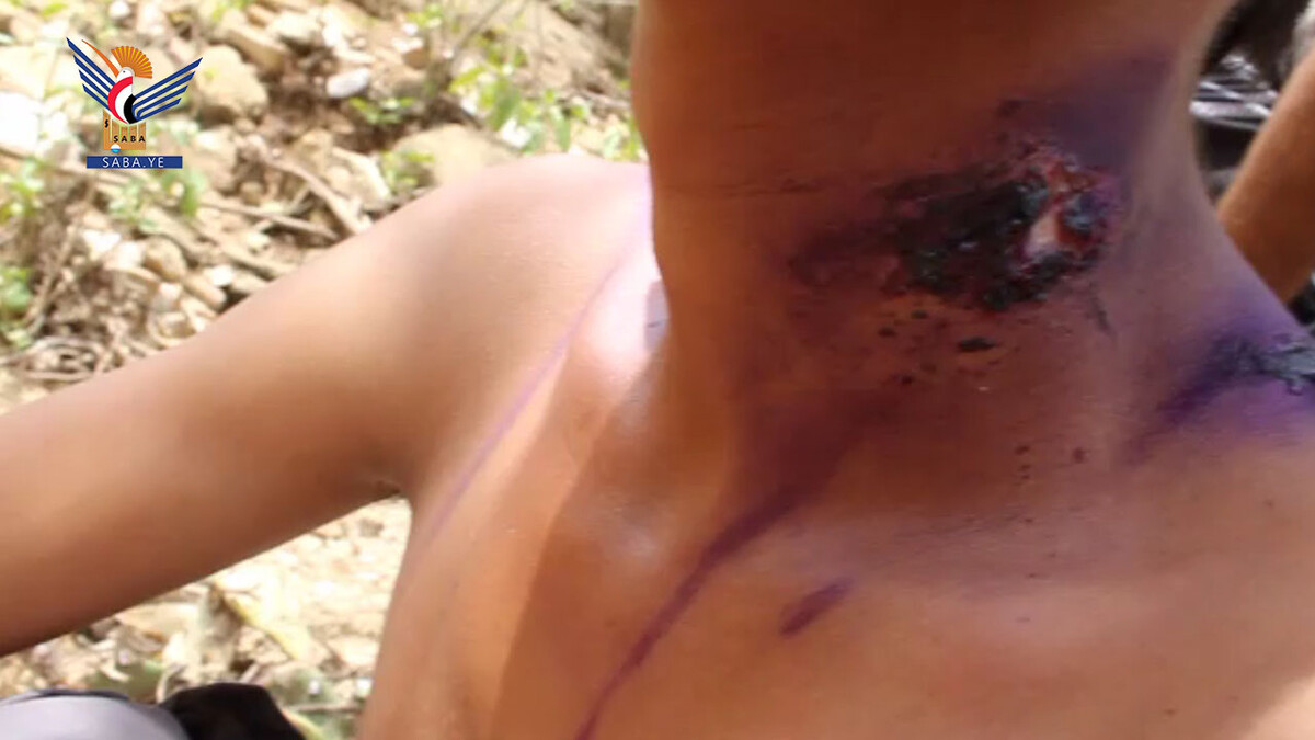 Un ciudadano murió y otros seis resultaron heridos en los distritos de Dhahir y Haidan debido a torturas perpetradas por el ejército saudíta