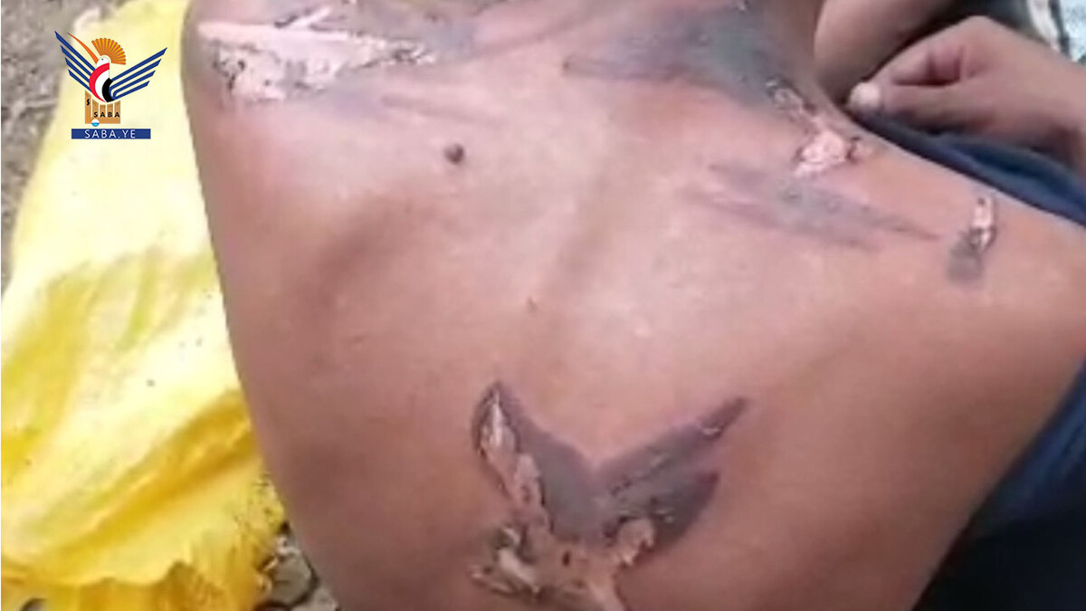 Un ciudadano murió y otros seis resultaron heridos en los distritos de Dhahir y Haidan debido a torturas perpetradas por el ejército saudíta