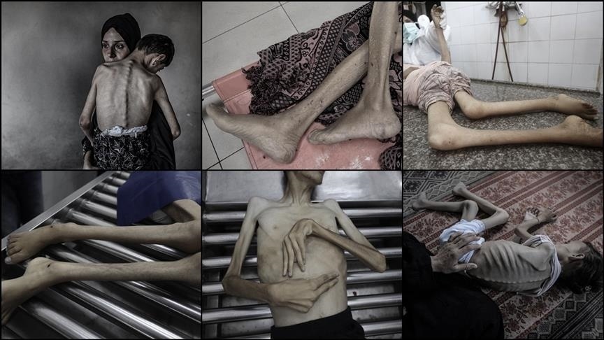 Los Niños palestinos... Un capítulo sangriento del genocidio sionista