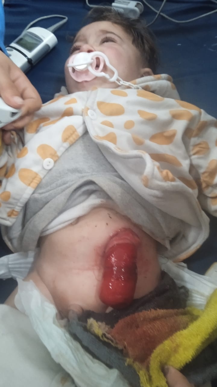 La familia Asaliya en Gaza: Dos hermanos luchan contra la muerte neurológica y la desnutrición... y el enemigo asedia la esperanza
