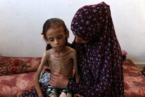Niños de Gaza: Cuerpos delgados, ojos hundidos y vidas torturadas por el hambre sionista