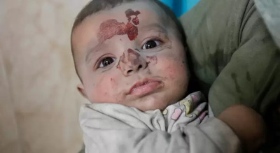 الوحيدي: متوسط 5 شهداء يومياً في غزة رغم الهدنة