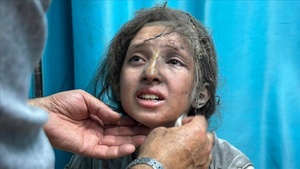 Douha cuenta la historia de los niños y niñas amputados de Gaza y sus sueños